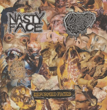 Fetal Deformity : Deformed Faces